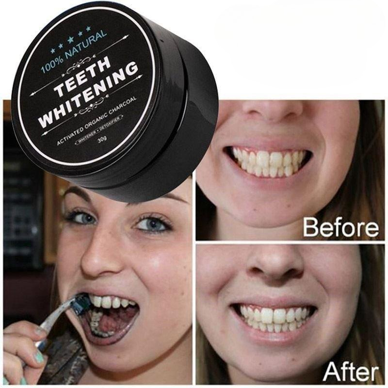 1 Box Activated Charcoal Teeth - Activated Charcoal Powder ulasan dan harga
